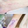 scar-birthmark-tattoo-cover-ups-105-5c093478b92cb__700