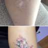 scar-birthmark-tattoo-cover-ups-106-5c093512ef012__700