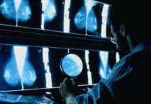 Нов метод открива повеќе од 50 вида рак во рана фаза