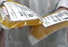 Досега со конвалесцентна плазма третирани над 400 пациенти со ковид-19