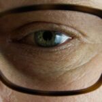 Синдромот на мрзливо око е знак за здравствени проблеми