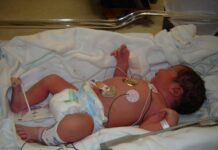 Вонреден надзор на Гинекологија по смртта на новороденче, побара Алиу